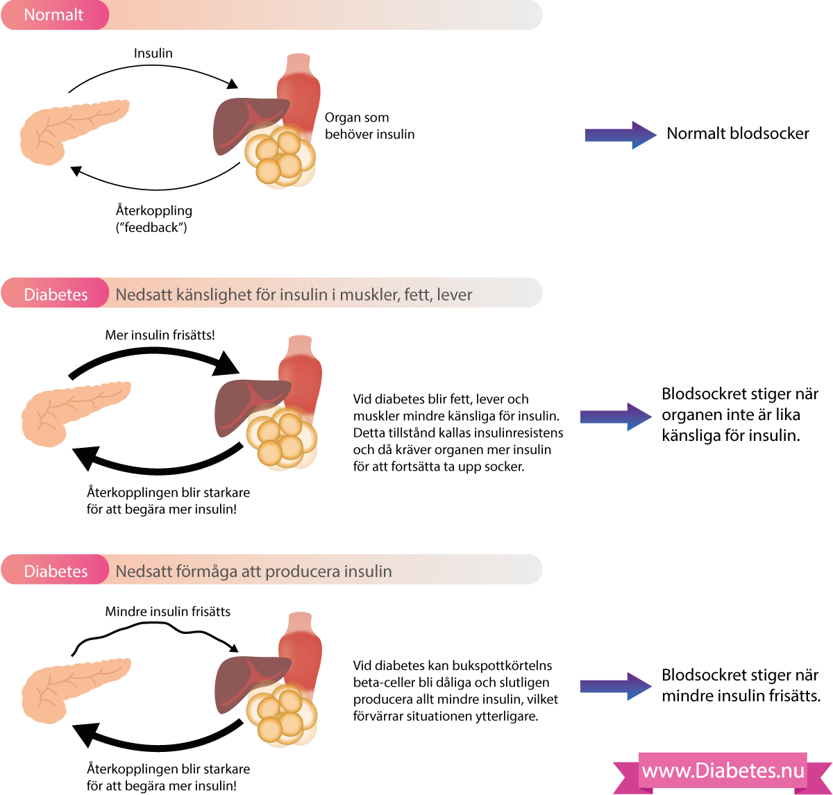 Som framgår av denna figuren så frisätts insulin från bukspottkörteln (beta-cellerna). Insulinet signalerar till insulinkänsliga organ (muskler, fett, lever) att ta upp socker (glukos) från blodet. Allteftersom sockret tas upp så minskar sockerbehovt i vävnaderna och då signalerar de tillbaka till bukspottkorteln så att frisättningen av insulin kan minskas. På så vis finns en återkoppling mellan insulinkänsliga organ och bukspottkörteln (beta-celler).