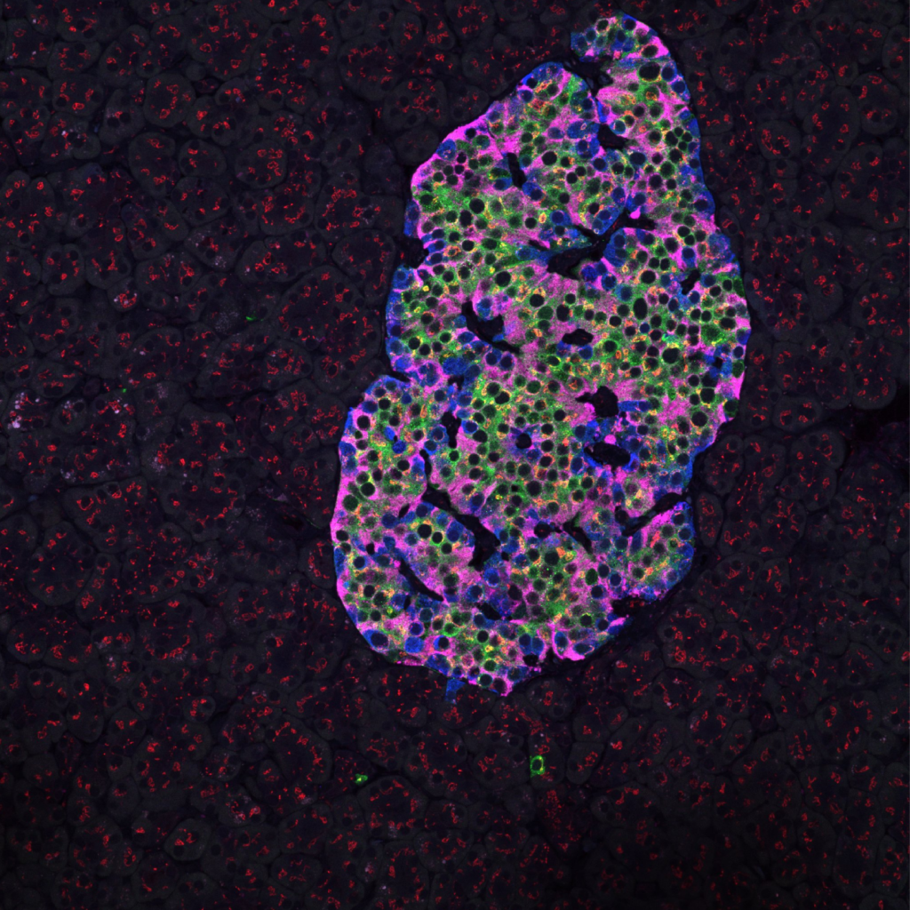 Insulin insulinbehandling vid diabetes