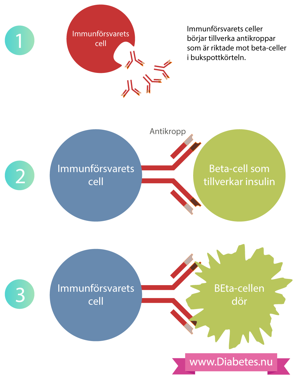 Denna bilden visar hur immunförsvarets celler tillverkar antikroppar som sedan fäster till beta-cellerna. Antikropparna lockar andra immunceller och dessa celler döda beta-cellerna. Då kan man inte längre tillverka insulin och man får typ 1 diabetes.