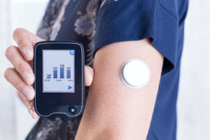 Kontinuerlig mätning av blodsocker med CGM