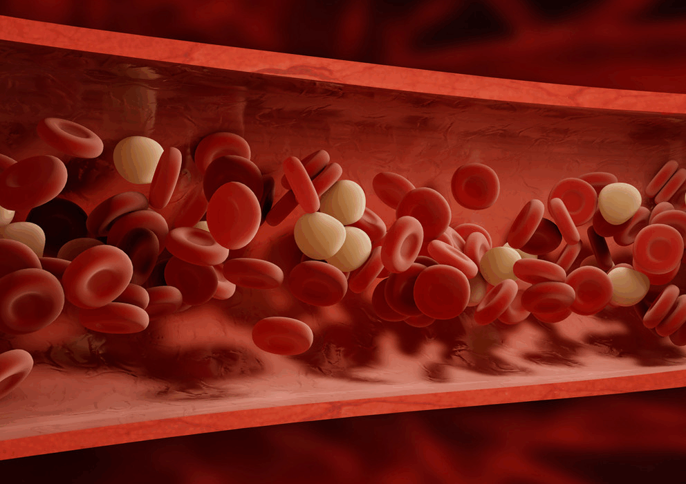 blodfetter högt kolesterol blodkärl diabetes hjärta sjukdomar åderförfettning ateroskleros